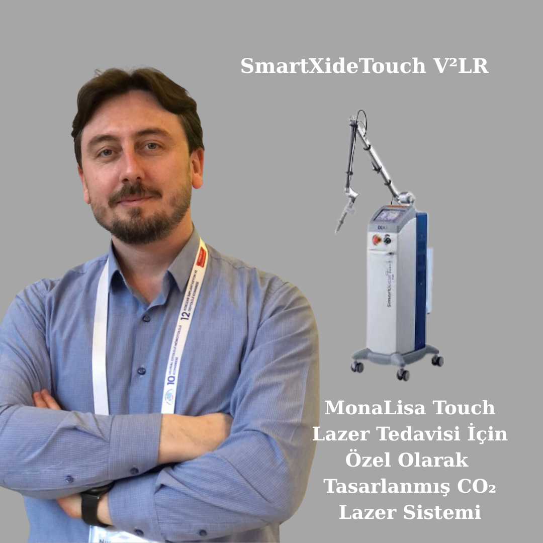 Monalisa Touch Lazer Tedavisi İçin Özel Olarak Tasarlanmış Co₂ Lazer Sistemi