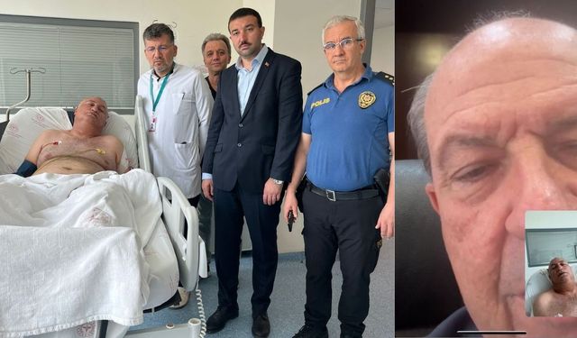 KKTC Cumhurbaşkanı Ersin Tatar, yaralı polis memuru Adem Altun ile görüntülü görüştü