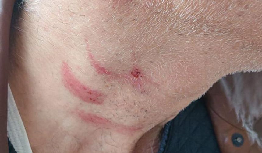 Müezzinin, sıra yüzünden aile hekimini darbettiği iddiası