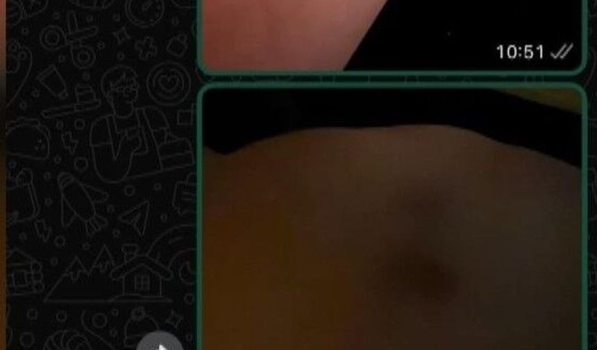 İlişkisini bitirmek istedi darbedilip burnu kırıldı